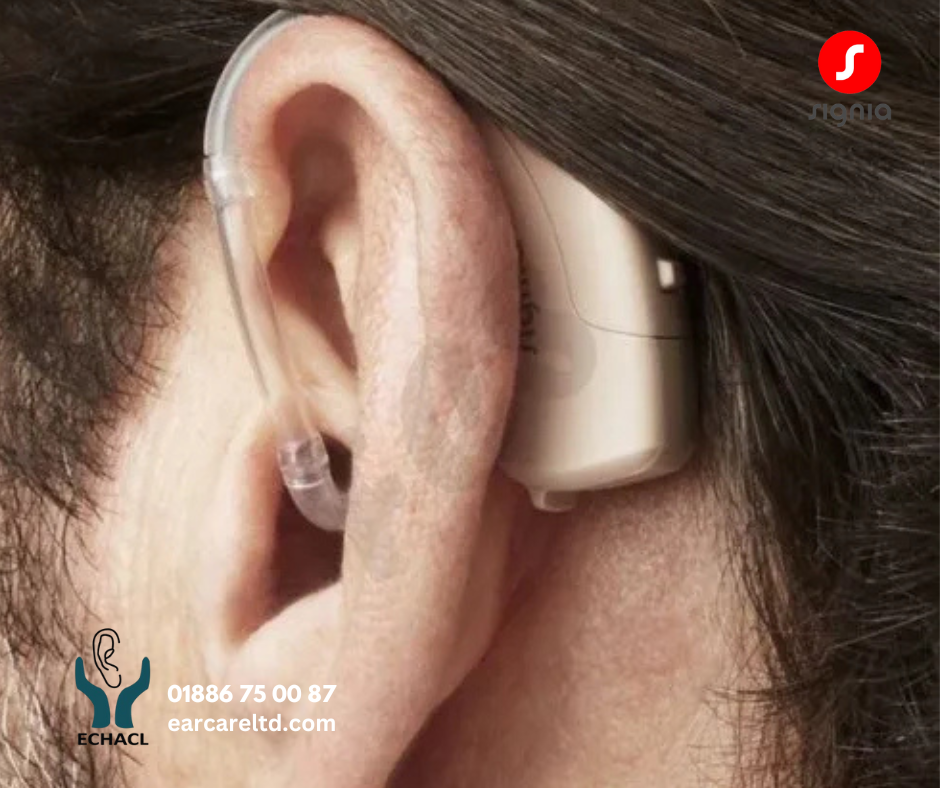 Signia Intuis SP 4.0 BTE Hearing Aid - Image 2